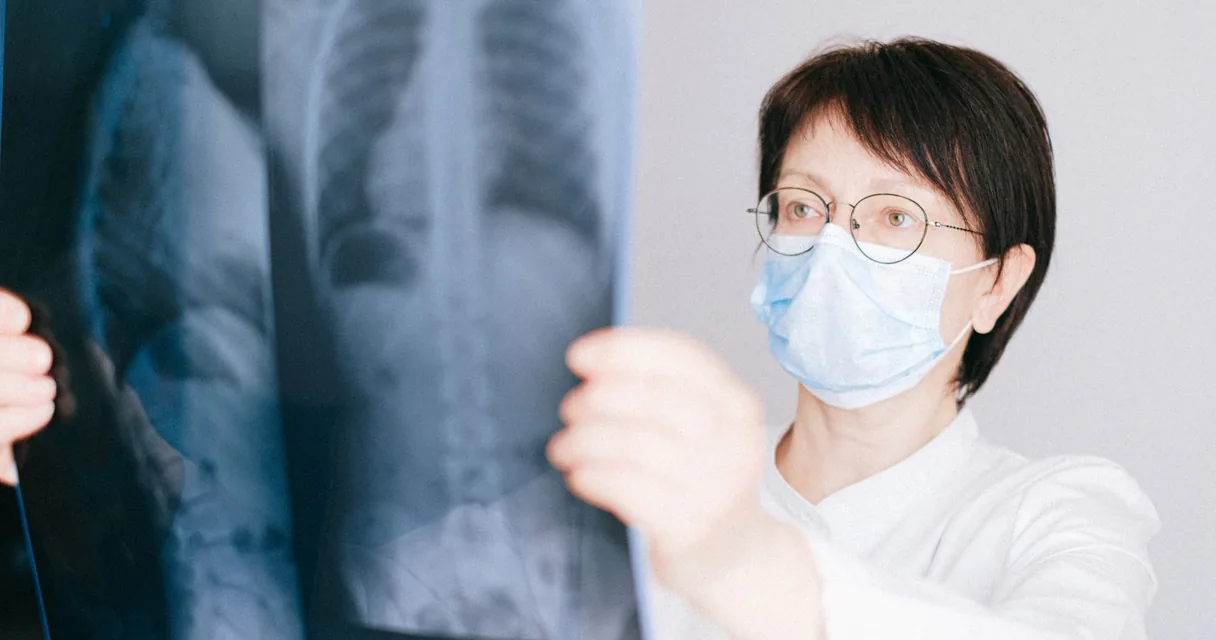 Médico analisando uma radiografia de tórax