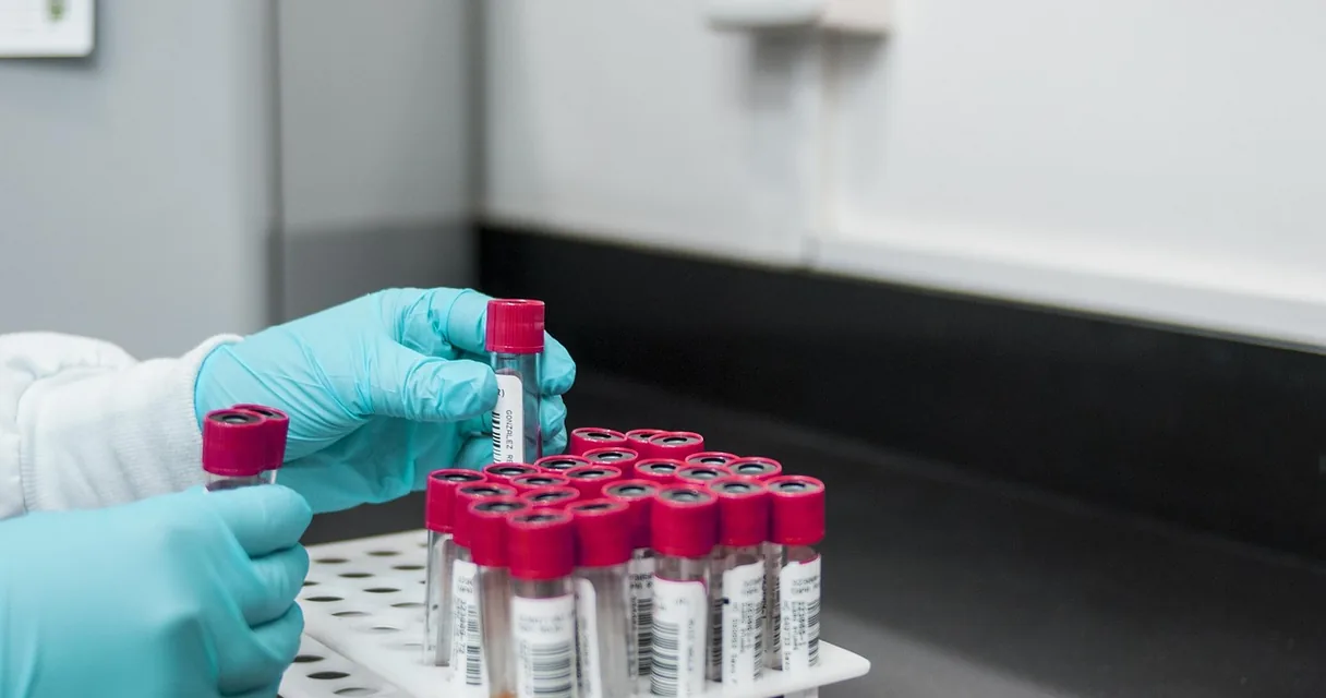 Tubos de ensaio com tampas vermelhas em uma bandeja de laboratório, ilustrando o exame toxicológico