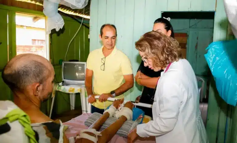 Mais de 40 pacientes são atendidos pelo ‘Programa Melhor em Casa’, em Cruzeiro do Sul