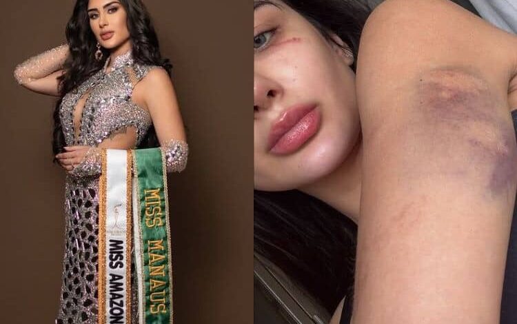 Miss Amazonas denuncia ter sido espancada e ameaçada por namorado