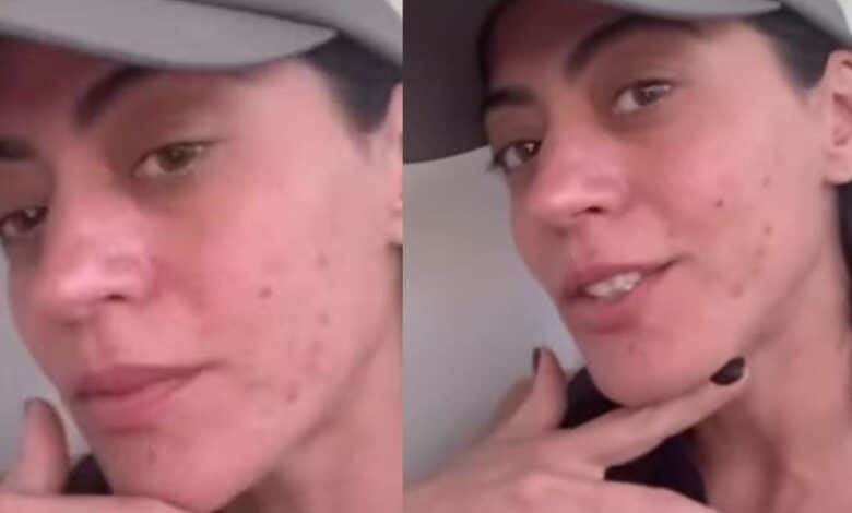 Clarice de 'Garota do Momento', Carol Castro tem doença crônica; médica alerta sobre diagnóstico e cuidados: 'É recomendável evitar...'