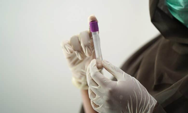 Sangue com característica única é encontrado em mulher; o que isso significa? Entenda melhor a informação.