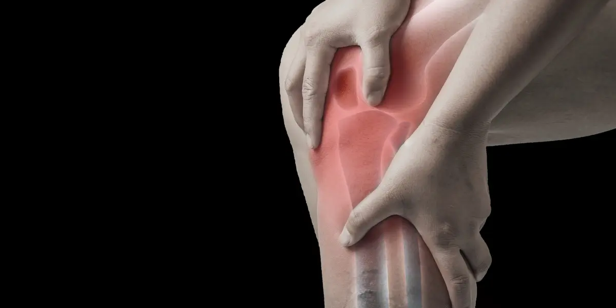 Hoffite Tem Cura? Descubra as Opções de Tratamento