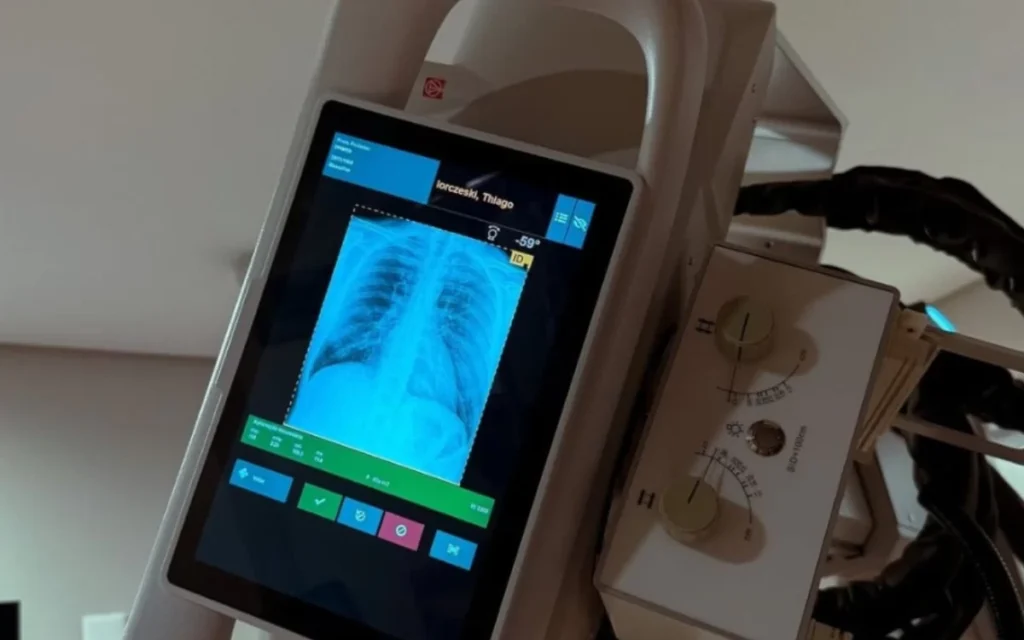 O que é a hérnia de disco cervical?