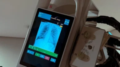 O que é a hérnia de disco cervical?