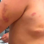 Mãe de autista agredida defende padrasto em áudio