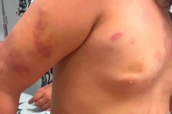 Mãe de autista agredida defende padrasto em áudio