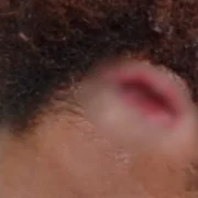 Homem ataca ex e amigos com barra de ferro e foge no Santa Luzia